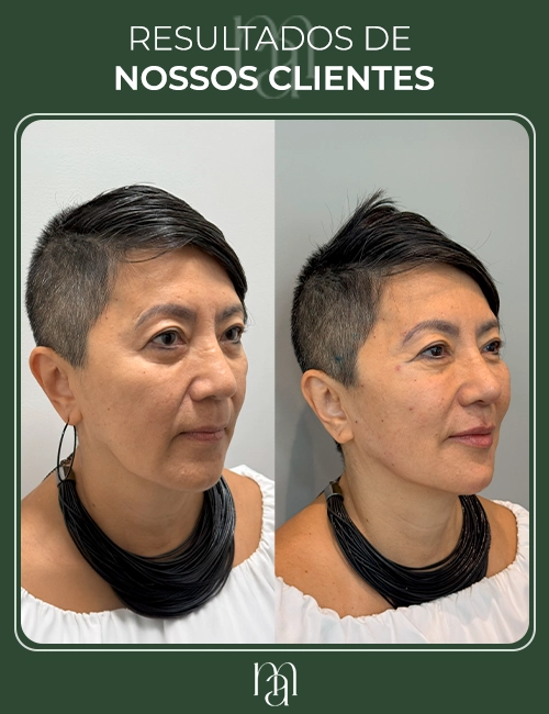 Resultados dos clientes 01