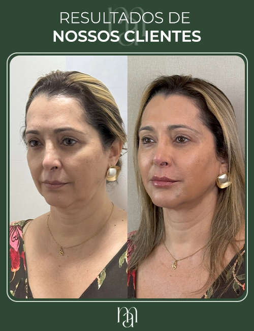 Resultados dos clientes 02