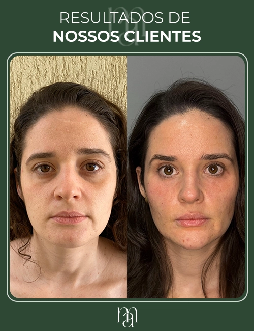 Resultados dos clientes 03