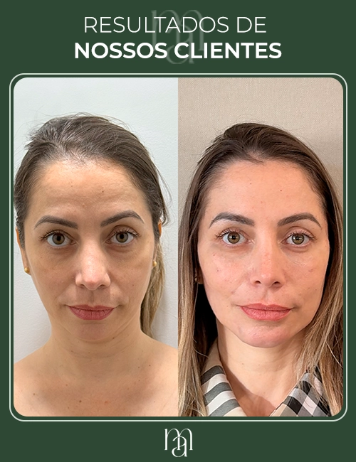 Resultados dos clientes 04