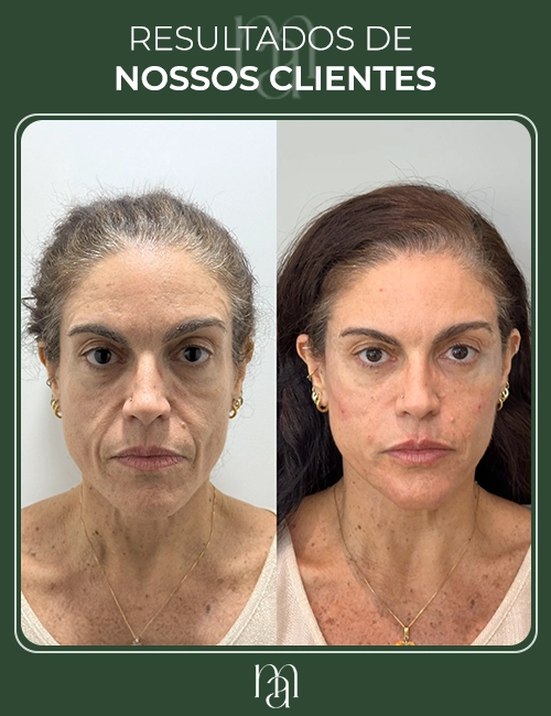 Resultados dos clientes 05