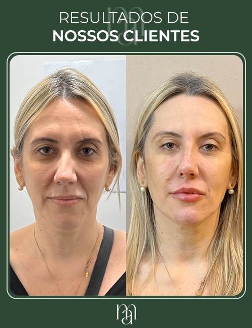 Resultados dos clientes 06